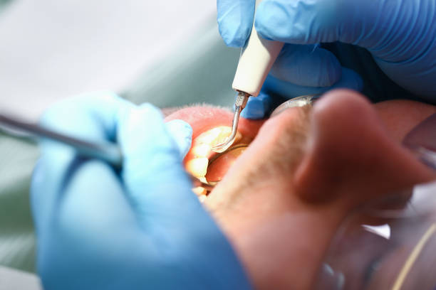 Best Urgent Tooth Repair  in Start, LA